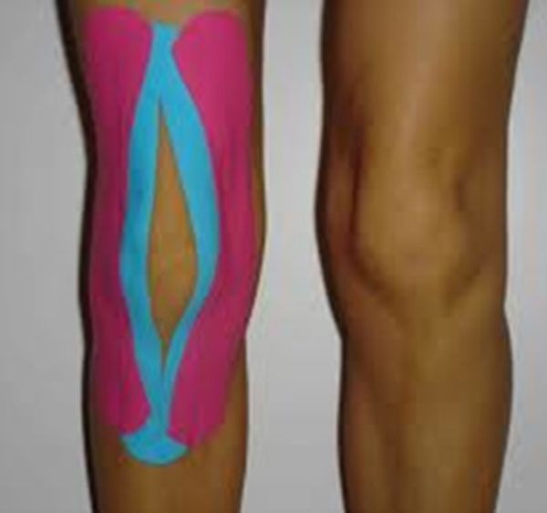 Kinesiotaping